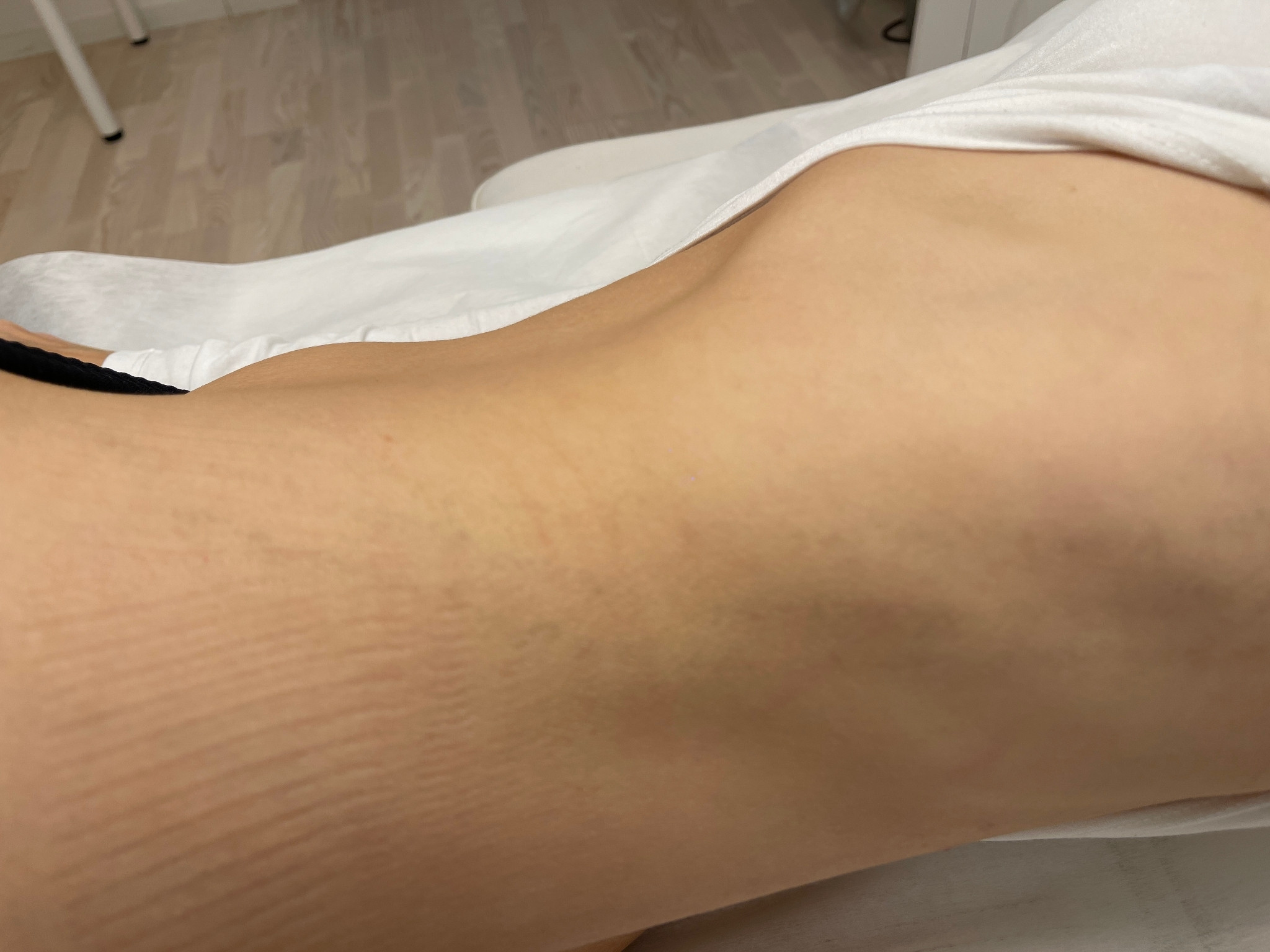 Efter behandling