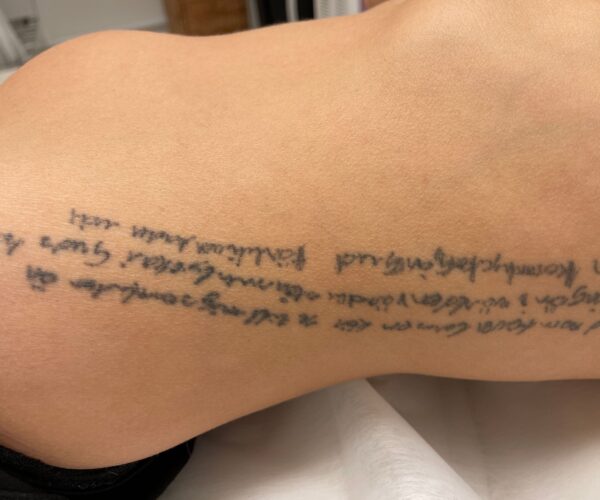 Tatueringsblekning före – tatuering på sidan av överkroppen innan behandling