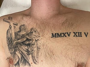 Före tatueringsborttagning